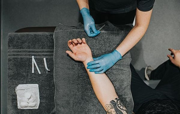 Acupuncture Insurance